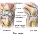 브로쥬아 이미지