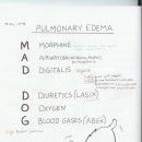 pulmonary edema 이미지