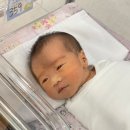 NR-5[경북대로]-상-292 | 6개월 아기 사두증, 부산 지오 헬멧 시작