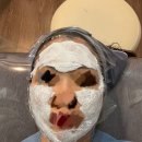 리즈온의원 | 피부과 후기_분당 서현 피부과 리즈온의원(내돈내산 무보정 솔직후기!)-릴리이드 M 스킨부스터