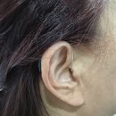 미래보청기 | 천안보청기 50대 여성 유전성 난청으로 인한 실제후기