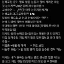 경남1 | 경남 진주 쌍꺼풀 수술 후기 1 (쌍수전후 사진)