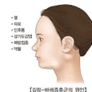 길랑바레 증후군 초기증상 하하 길랑바레 원인 완치 치료 이미지