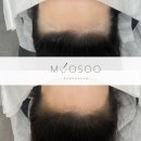 햇빛헤어라인 - 북구 | 햇빛헤어라인