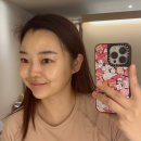 뷰티하퍼 | 구로신도림에스테틱 엘뷰티 레메디에서 얼굴 수분관리 후기