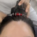 헤드스파케이