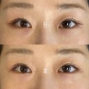 지에스(GS)25 대봉서한점 | 대구 중구 대봉동 다크서클커버업 자연스럽게 잘 하는 곳 @뮤롬