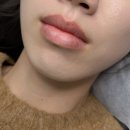 루비아뷰티 | 자연스럽게 예쁜 입술 완성! 동탄 루비아뷰티 후기