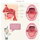목낀때빼 | 편도에 낀 알갱이 직접 빼본 후기, 그냥 넘기면 안 되는 이유