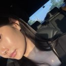 와이랩성형외과의원 | 와이랩성형외과 스컬트라 3차 시술 후기(한달경과 리얼후기)