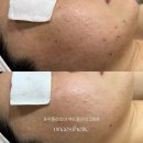 딥퓨어홈케어 이미지