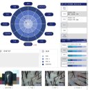 뽕뽕부분정비 | 최신식 기기로 두피 건강 챙길 수 있는 웰킨두피탈모센터 분당야탑점