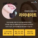 무삭제 라미네이트 밀리네이트 후기 실패하지 않으려면