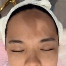 수화약국 | 송파에스테틱 쁘에르에스테틱 홍조 여드름관리 수화강테라피 후기