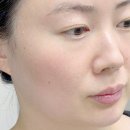 홍조바다 | 홍조 잡는 화잘먹 패드? 정샘물 에센셜 물 프렙 겔 패드 내돈내산 후기