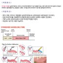 e덴쳐치과기공소 | 덴쳐 Denture &gt;폴리싱/피니싱&gt; BUR(카바이드/다이아/덴쳐/폴리싱)&gt; 진료재료
