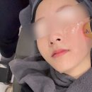 연신내로 | 연신내 피부과 티타늄리프팅 40kj 내돈내산 후기, 효과