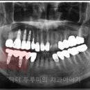 굿치과기공소 이미지