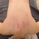 베이시스커피 | 부천 경락 부천 체형관리 베이시스(BASIS) 전신밸런스 관리 후기