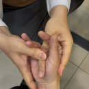 푸른청신경과의원 | 대구손가락 치료 위해 천안, 아산에서 오신 이야기