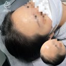 프로스칼프부산 이미지