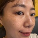 에코레비 에스테틱 | 에코레비에스테틱 : 동래 헤드스파 동래 두피관리 솔직후기