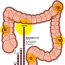 갑자기 대변 굵기가 가늘어졌다면? 이미지