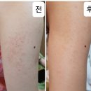 이소영스킨앤바디