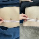 라니뷰티 | 정관피부관리 추천, 정관에스테틱 라니뷰티 복부빼빼관리 받은 솔직 후기