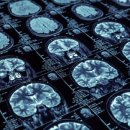 스카이닥터스 이미지