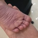 대지어린이집 | 12개월 돌아기 수족구 첫날 증상 후기｜어린이집 0세반 감염부터 확진까지, 초기에 몰랐던 변화
