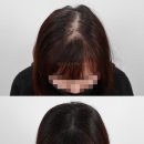 리게인프로젝트 강남본점 이미지