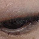 컴포트성형외과의원 이미지