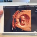 연세봄산부인과의원 이미지