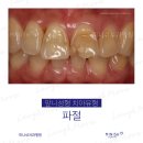 미니쉬치과병원 이미지