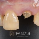 다인치과기공소 이미지