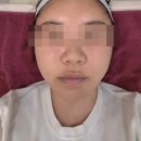 [청담] 루틴의원 | BBL 인플루언서 샷 + 지방분해주사 | 친절하고 전문적인 신상 피부과 추천