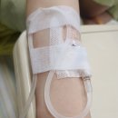 천보수산 | 본인이 관우 or 레버넌트인줄 알고 살았던 여자의 수술 후기