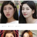 박헤어라인 네이버블로그