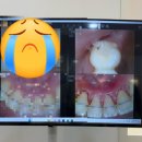유치과의원 | [ 위드유치과교정과의원 ] 경기도 평택 교정치과추천 치과정기검진 스케일링잘하는곳