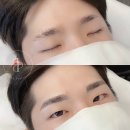 비프리티 이미지