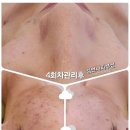 서산 피부관리 김언니 피부샵 윤곽관리 대만족 솔직후기