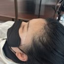 팡팡헤어 - 계양구 | 소레아 두피팡팡 헤어라인 후기
