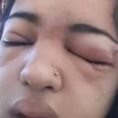 셀프피어싱 이미지