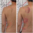 모이라 | 수기&amp;데콜데 '모이라에스테틱 수원본점' 받은 솔직후기