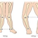 리바이브 체형교정