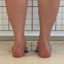 클린 케어(C.L.E.A.N. Care) | 마포 다이어트 관리 클린케어 포톤관리 체형교정 후기