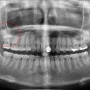 뿌리앤치과의원 이미지