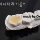 금천치과기공소 이미지