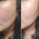 AP BEAUTY 백화점 NO.1 피부 관리 시너지 크림 에이피 듀얼 리페어 리프트크림 적극추천합니다.